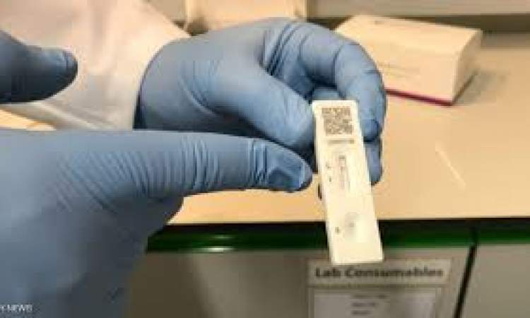 الكشف عن فحص لكورونا تظهر نتيجته خلال دقائق