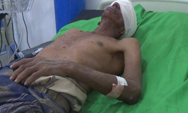 استشهاد واصابة 3 مواطنين بقصف للمرتزقة في تعز