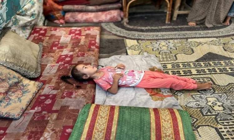 الأمم المتحدة تعلن وصول سوء التغذية الحاد بين الأطفال بغزة لأعلى مستوى