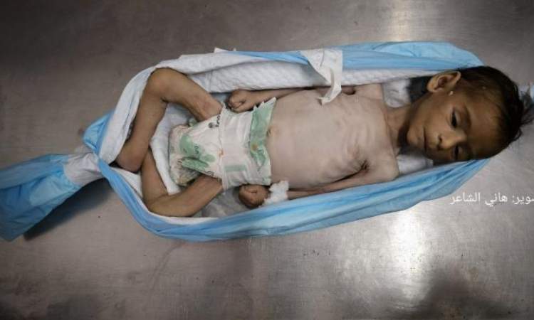 ارتفاع عدد ضحايا المجاعة بغزة إلى 163 شهيدًا بينهم 112 طفلًا