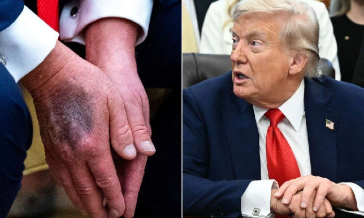 "ترامب ميت" وسم يتصدر منصات التواصل